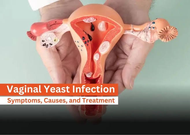 Vaginal infection treatment
